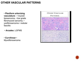 Aborizing Pattern Comprehensive Diagnostic Approach to Soft Tissue Tumors: Classification ...