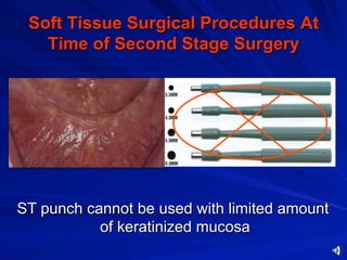 Soft tissue procedures | PDF