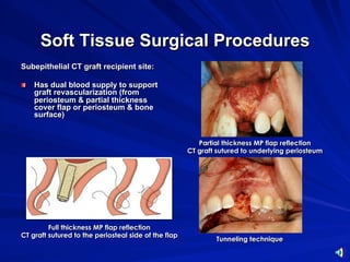 Soft tissue procedures | PDF