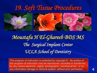 19. Soft Tissue Procedures

Moustafa H El-Ghareeb BDS MS
The Surgical Implant Center
UCLA School of Dentistry
This program of instruction is protected by copyright ©. No portion of
this program of instruction may be reproduced, recorded or transferred
by any means electronic, digital, photographic, mechanical etc., or by
any information storage or retrieval system, without prior permission.

 