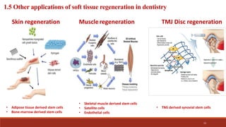 Dental Soft tissue regeneration | PPTX