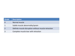 Grade Description
0 Normal muscle
1 Subtle muscle abnormality/sprain
2 Definite muscle disruption without muscle retraction
3 Complete muscle tear with retraction
 