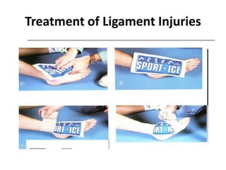 Treatment of Ligament Injuries
 