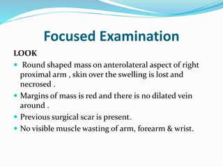 Focused Examination
LOOK
 Round shaped mass on anterolateral aspect of right
proximal arm , skin over the swelling is lost and
necrosed .
 Margins of mass is red and there is no dilated vein
around .
 Previous surgical scar is present.
 No visible muscle wasting of arm, forearm & wrist.
 