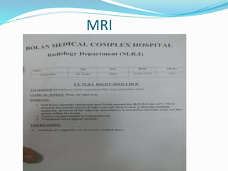 MRI
 