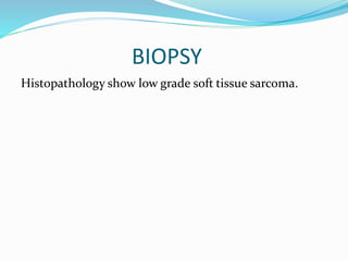 BIOPSY
Histopathology show low grade soft tissue sarcoma.
 