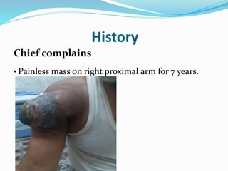 History
Chief complains
• Painless mass on right proximal arm for 7 years.
 