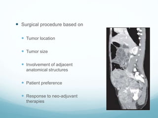  Surgical procedure based on
 Tumor location
 Tumor size
 Involvement of adjacent
anatomical structures
 Patient preference
 Response to neo-adjuvant
therapies
 