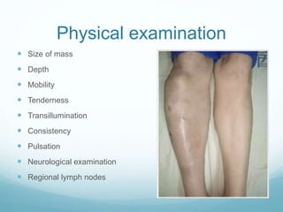 Physical examination
 Size of mass
 Depth
 Mobility
 Tenderness
 Transillumination
 Consistency
 Pulsation
 Neurological examination
 Regional lymph nodes
 