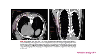 Perez and Brady’s 6TH
 
