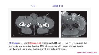 CT MRI(T1)
Perez and Brady’s 6TH
MRIScanvs CTScan(Demas et al. compared MRI and CT for STS lesions in the
extremity and reported that for 23% of cases, the MRI scans showed tumor
involvement in muscles that appeared normal on CT scan)
 