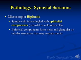 Pathology: Synovial Sarcoma
• Microscopic: Biphasic
• Spindle cells intermingled with epithelial
components (cuboidal or columnar cells)
• Epithelial components form nests and glandular or
tubular structures that may contain mucin
 