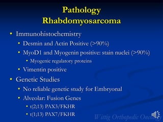 Pathology
Rhabdomyosarcoma
• Immunohistochemistry
• Desmin and Actin Positive (>90%)
• MyoD1 and Myogenin positive: stain nuclei (>90%)
• Myogenic regulatory proteins
• Vimentin positive
• Genetic Studies
• No reliable genetic study for Embryonal
• Alveolar: Fusion Genes
• t(2;13) PAX3/FKHR
• t(1;13) PAX7/FKHR
 
