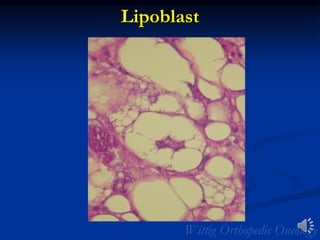 Lipoblast
 