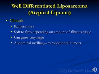 Well Differentiated Liposarcoma
(Atypical Lipoma)
• Clinical:
• Painless mass
• Soft to firm depending on amount of fibrous tissue
• Can grow very large
• Abdominal swelling—retroperitoneal tumors
 