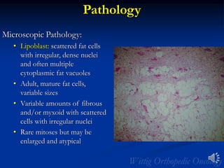 Pathology
Microscopic Pathology:
• Lipoblast: scattered fat cells
with irregular, dense nuclei
and often multiple
cytoplasmic fat vacuoles
• Adult, mature fat cells,
variable sizes
• Variable amounts of fibrous
and/or myxoid with scattered
cells with irregular nuclei
• Rare mitoses but may be
enlarged and atypical
 
