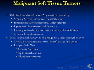 Malignant Soft Tissue Tumors
• Calcification/Mineralization: Any sarcoma can calcify
• Synovial Sarcoma notorious for calcification
• Extraskeletal Chondrosarcoma/Osteosarcoma
• Lipoma or Liposarcoma with Necrosis
• Hemangioma—benign soft tissue tumor with calcification
• Synovial Chondromatosis
• Metastases: usually always to the lungs first, then bones, then liver
• Myxoid liposarcoma mets to other soft tissues and bones
• Lymph Node Mets
• Synovial Sarcoma
• Epithelioid Sarcoma
• Rhabdomyosarcoma
 