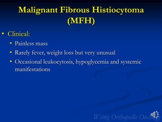 Malignant Fibrous Histiocytoma
(MFH)
• Clinical:
• Painless mass
• Rarely fever, weight loss but very unusual
• Occasional leukocytosis, hypoglycemia and systemic
manifestations
 