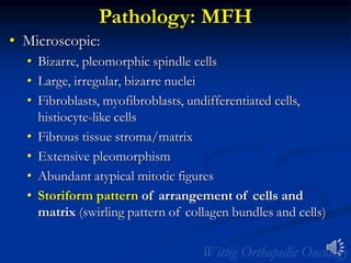 Pathology: MFH
• Microscopic:
• Bizarre, pleomorphic spindle cells
• Large, irregular, bizarre nuclei
• Fibroblasts, myofibroblasts, undifferentiated cells,
histiocyte-like cells
• Fibrous tissue stroma/matrix
• Extensive pleomorphism
• Abundant atypical mitotic figures
• Storiform pattern of arrangement of cells and
matrix (swirling pattern of collagen bundles and cells)
 