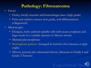 Pathology: Fibrosarcoma
• Gross:
• Fleshy, focally necrotic and hemorrhagic mass (high grade)
• Firm and rubbery masses (low grade, well differentiated,
collagenized)
• Microscopic:
• Elongate, fairly uniform spindle cells with scant cytoplasm and
large nuclei in a variable amount of fibrous stroma
• Minimal pleomorphism
• Herringbone pattern: Arranged in fascicles that intersect at right
angles
• Mitoses present; also abnormal mitoses (Increase in Grade 2 and
Grade 3 Tumors)
 