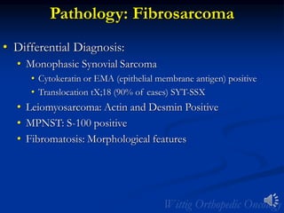 Pathology: Fibrosarcoma
• Differential Diagnosis:
• Monophasic Synovial Sarcoma
• Cytokeratin or EMA (epithelial membrane antigen) positive
• Translocation tX;18 (90% of cases) SYT-SSX
• Leiomyosarcoma: Actin and Desmin Positive
• MPNST: S-100 positive
• Fibromatosis: Morphological features
 