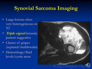 Synovial Sarcoma Imaging
• Large lesions often
very heterogeneous on
T2
• Triple signal intensity
pattern suggestive
• Cluster of grapes
(septated/multilocular)
• Hemorrhage/fluid
levels/cystic areas
 