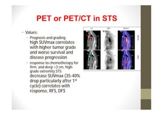 PET or PET/CT in STS
• Values:
  • Prognosis and grading:
    high SUVmax correlates
    with higher tumor grade
    and worse survival and
    disease progression
  • response to chemotherapy for
    firm, and deep >3 cm, high-
    grade extremity STS:
    decrease SUVmax (35-40%
    drop particularly after 1st
    cycle) correlates with
    response, RFS, DFS
 