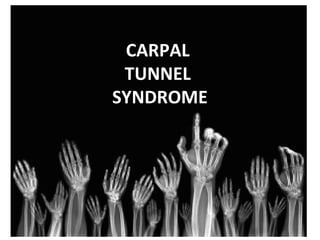 CARPAL
TUNNEL
SYNDROME

 