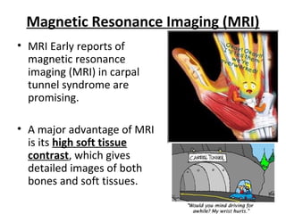 Magnetic Resonance Imaging (MRI)
• MRI Early reports of
magnetic resonance
imaging (MRI) in carpal
tunnel syndrome are
promising.
• A major advantage of MRI
is its high soft tissue
contrast, which gives
detailed images of both
bones and soft tissues.

 