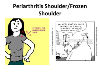 Periarthritis Shoulder/Frozen
Shoulder

 