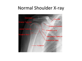 Normal Shoulder X-ray

 