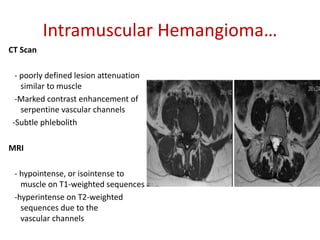 Intramuscular Hemangioma…
CT Scan
- poorly defined lesion attenuation
similar to muscle
-Marked contrast enhancement of
serpentine vascular channels
-Subtle phlebolith
MRI
- hypointense, or isointense to
muscle on T1-weighted sequences
-hyperintense on T2-weighted
sequences due to the
vascular channels
 