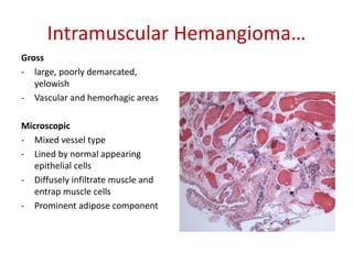 Intramuscular Hemangioma…
Gross
- large, poorly demarcated,
yelowish
- Vascular and hemorhagic areas
Microscopic
- Mixed vessel type
- Lined by normal appearing
epithelial cells
- Diffusely infiltrate muscle and
entrap muscle cells
- Prominent adipose component
 