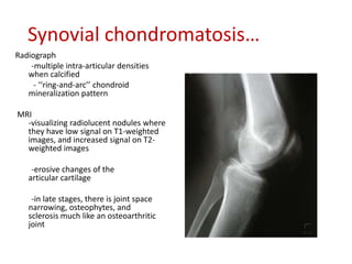 Synovial chondromatosis…
Radiograph
-multiple intra-articular densities
when calcified
- ‘‘ring-and-arc’’ chondroid
mineralization pattern
MRI
-visualizing radiolucent nodules where
they have low signal on T1-weighted
images, and increased signal on T2-
weighted images
-erosive changes of the
articular cartilage
-in late stages, there is joint space
narrowing, osteophytes, and
sclerosis much like an osteoarthritic
joint
 