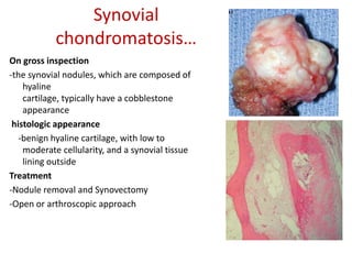 Synovial
chondromatosis…
On gross inspection
-the synovial nodules, which are composed of
hyaline
cartilage, typically have a cobblestone
appearance
histologic appearance
-benign hyaline cartilage, with low to
moderate cellularity, and a synovial tissue
lining outside
Treatment
-Nodule removal and Synovectomy
-Open or arthroscopic approach
 