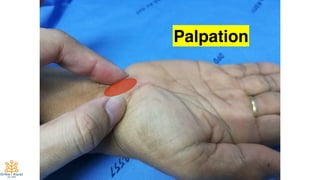 14
Palpation
 