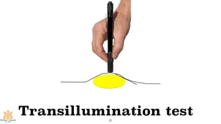 Transillumination test22
 