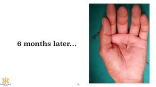 78
6 months later…
 