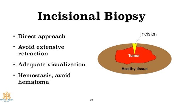 Approach to Soft Tissue Tumor in Upper Extremity diagram of epidermal inclusion cyst 