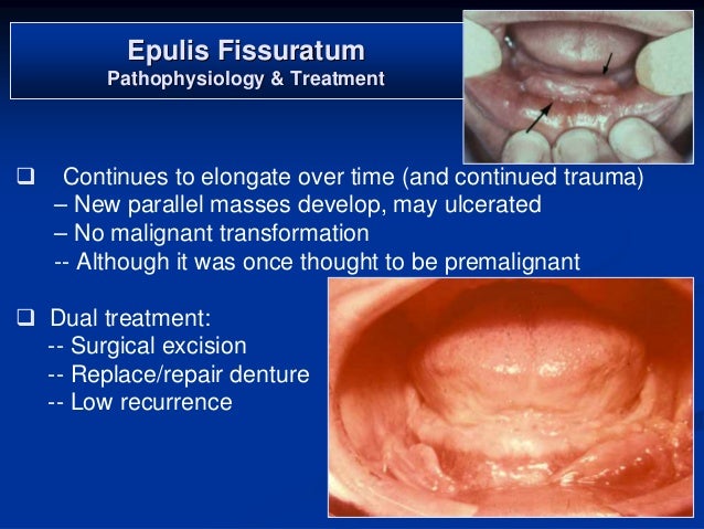 Soft tissue tumors 1 2007