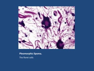 Pleomorphic lipoma.
The floret cells
 