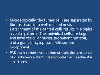• Microscopically, the tumor cells are separated by
fibrous tissue into well-defined nests.
Detachment of the central cells results in a typical
alveolar pattern . The individual cells are large
and have vesicular nuclei, prominent nucleoli,
and a granular cytoplasm. Mitoses are
exceptional.
• PAS stain sometimes demonstrates the presence
of diastase-resistant intracytoplasmic needle-like
structures .
 