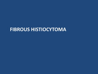 FIBROUS HISTIOCYTOMA
 