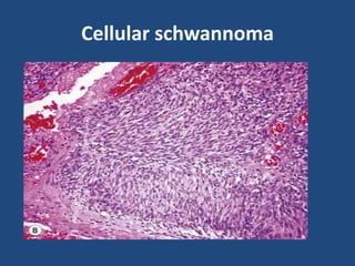 Cellular schwannoma
 
