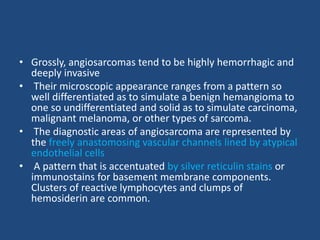 Angiosarcoma
Anastomosing vascular
channels.
On high power, the channels are seen to
be lined by highly atypical endotheli...