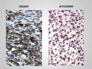 DESMIN MYOGENIN
 