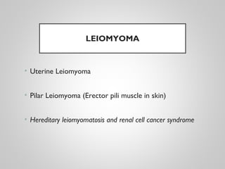 LEIOMYOMA
• Uterine Leiomyoma
• Pilar Leiomyoma (Erector pili muscle in skin)
• Hereditary leiomyomatosis and renal cell cancer syndrome
 