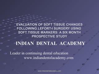 EVALUATION OF SOFT TISSUE CHANGES
FOLLOWING LEFORT-I SURGERY USING
SOFT TISSUE MARKERS: A SIX MONTH
PROSPECTIVE STUDY

INDIAN DENTAL ACADEMY
Leader in continuing dental education
www.indiandentalacademy.com

www.indiandentalacademy.com

 