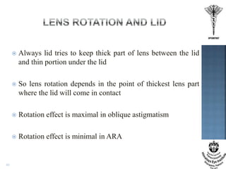 Contact Lens Rotation SOFT TORIC CONTACT LENS FITTING.pptx