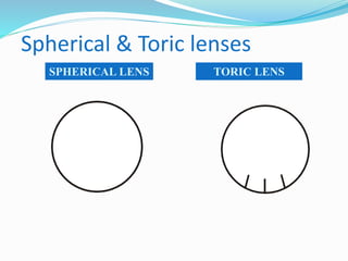 Spherical & Toric lenses
SPHERICAL LENS TORIC LENS
 